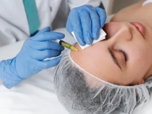 Practitioner performing a cosmetic or dermatological facial injection